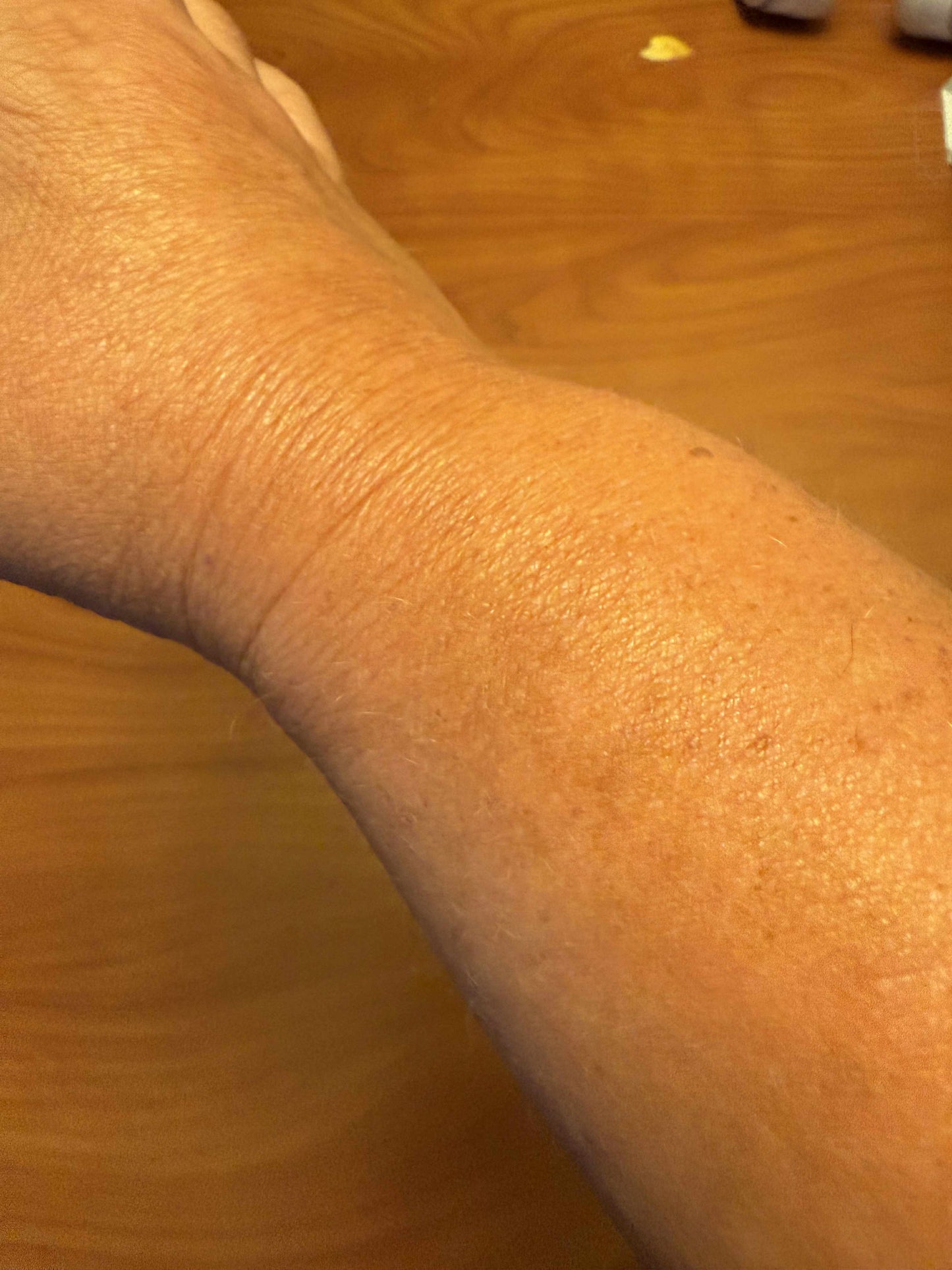 Eczema, Crepe & Scarred Skin Healing Wash & Balm with Manuka Honey/Snow Mushroom