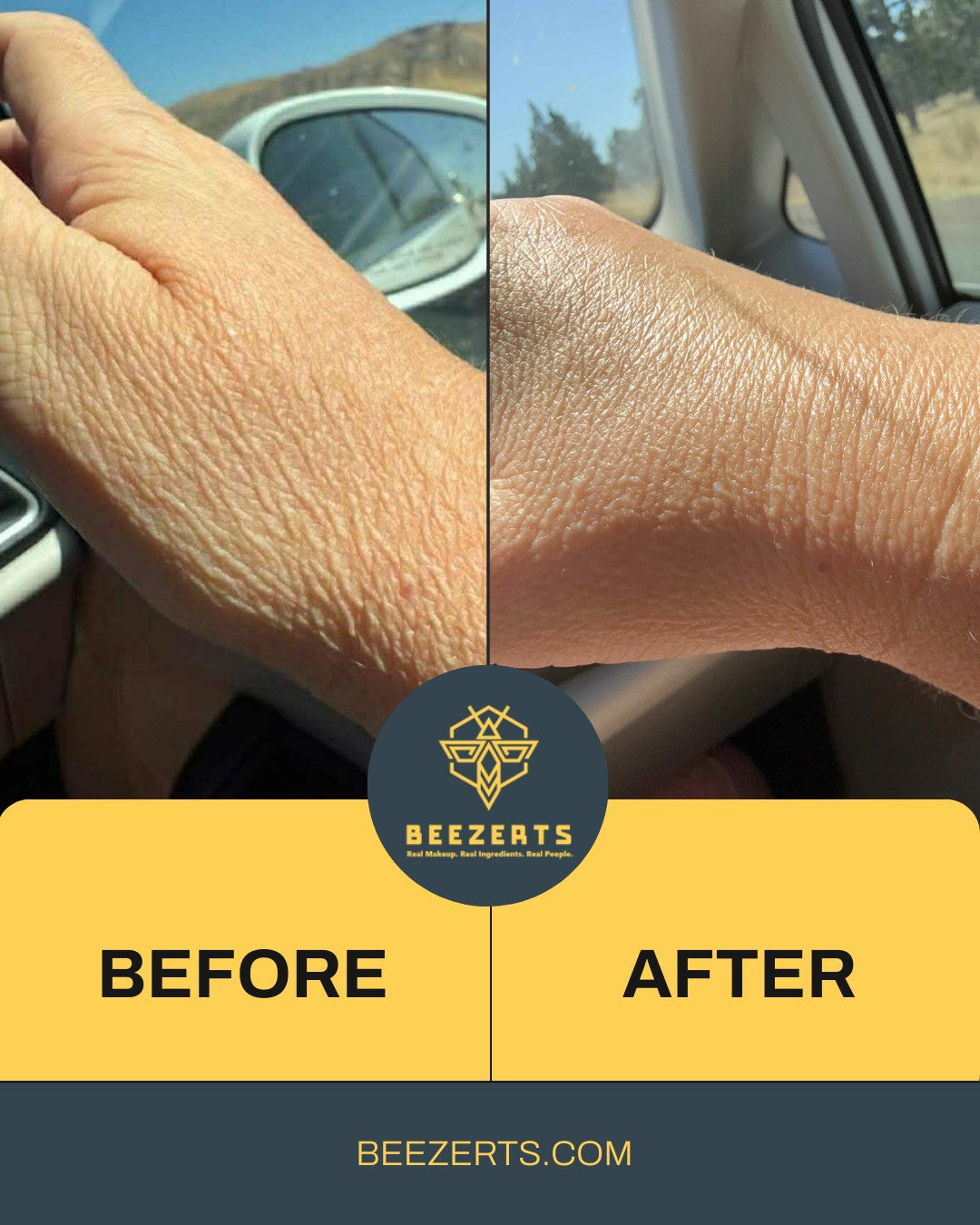 PRE-ORDER: Crepe, Wrinkle, and Scar Body Lotion 100 ml - Limited Stock