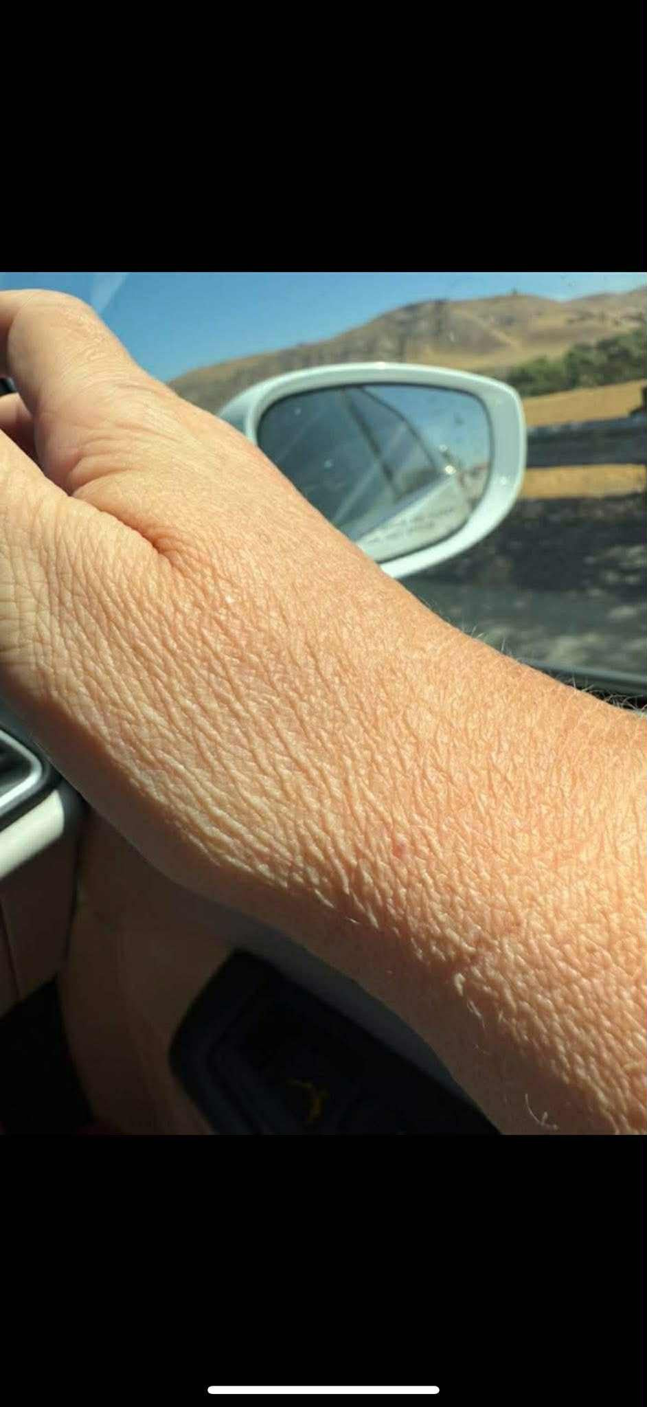 Eczema, Crepe & Scarred Skin Healing Wash & Balm with Manuka Honey/Snow Mushroom