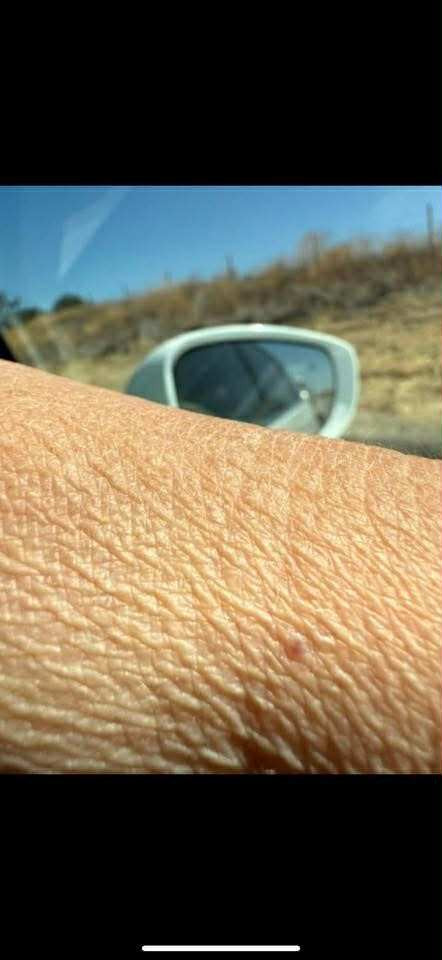 Eczema, Crepe & Scarred Skin Restorative Wash & Balm with Certified UMF 15+ (Medical Grade) Manuka Honey and Snow Mushroom